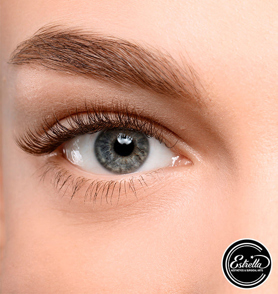 Restore Your Under Eyes With PLLA Collagen Threads