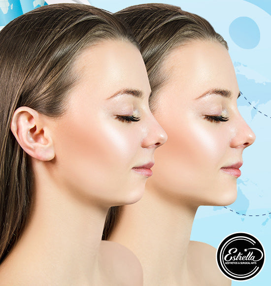 Sculpt a Sharper, More Defined Jawline With Tox ✨🎄