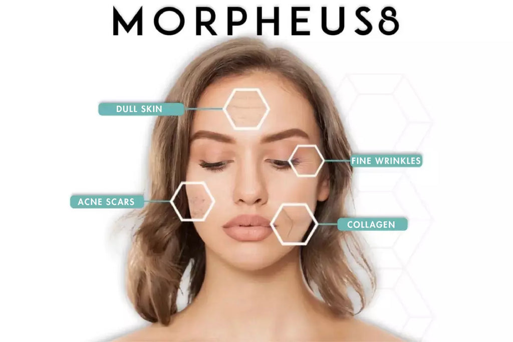 Glow Deeper. Look Younger: Morpheus8 Skin Renewal