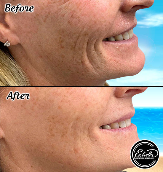 🇺🇸✨ Labor Day Lift & Glow with Smooth Threads! ✨🇺🇸